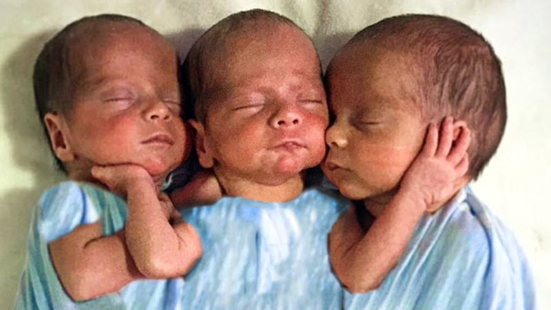 Mother Gives Birth To Triplets Doctor Gets Shocked When He Sees Their Faces Healthy George 