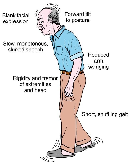 Mental Health And Parkinson's Disease - Healthy George