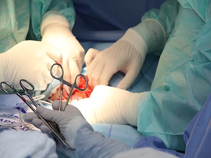 operation surgery medical